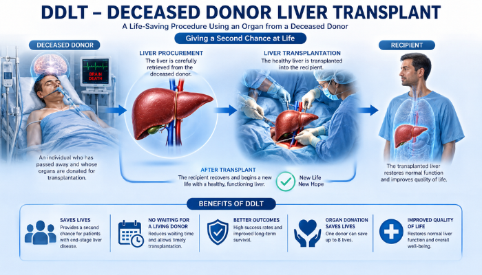 DDLT – Deceased Donor Liver Transplant