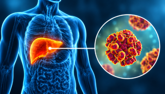 Hepatitis A & E: Causes, Symptoms, Prevention & Treatment
