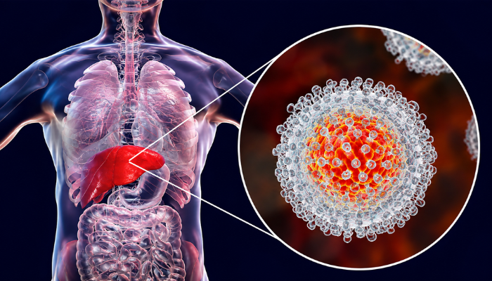 Hepatitis B: Symptoms, Causes, Prevention & Treatment